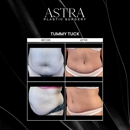 Astra Plastic Surgery - Alpharetta - Physicians & Surgeons, Plastic & Reconstructive