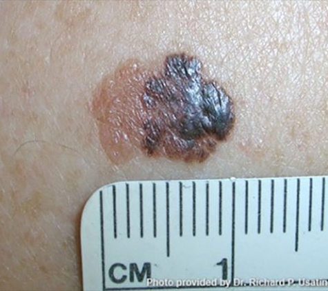Port Macquarie Skin Cancer Clinic - Port Macquarie, NSW