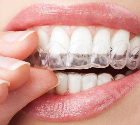 SINAI DENTAL - Van Nuys, CA. Invisalign