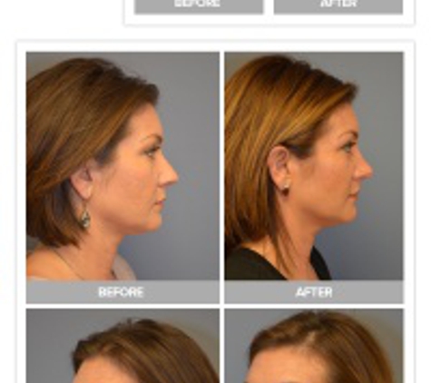 Dr. Constantine Plastic Surgery Center, MD - Dallas, TX