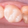 Staley Dental gallery