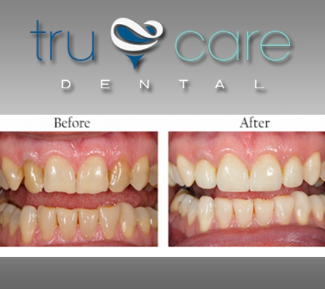 Tru Care Dental - Albuquerque, NM