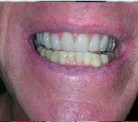 Crombie Dental Surgery - Hampton, VIC