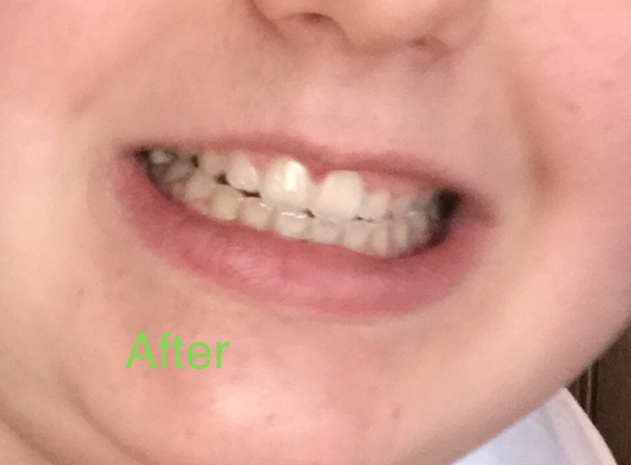 TEEM ORTHODONTICS - Gainesville, VA. After