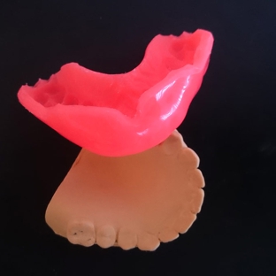 Complete Denture Clinic - Hamlyn Terrace, NSW