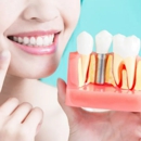 Ashland Family Dentistry - Implant Dentistry