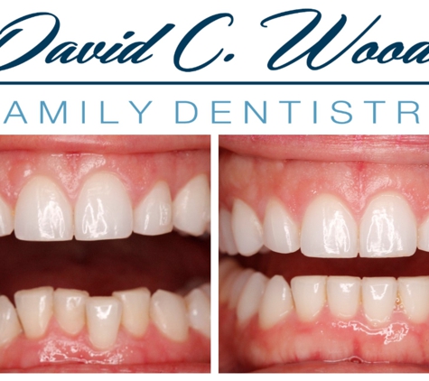 David Wood Family Dentistry - Carmel, IN