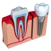 East Coast Dental Design: Mary Ann Garcia DDS gallery