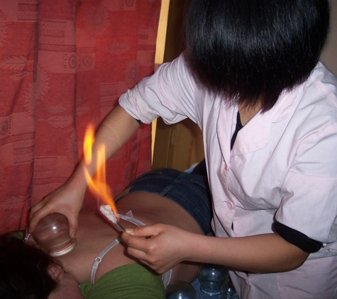 Acupuncture & Traditional Chinese Medicine - Rangeville, QLD