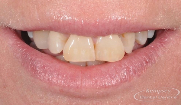 Kempsey Dental Centre - Kempsey, NSW