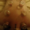 Balance Acupuncture gallery