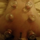 Balance Acupuncture