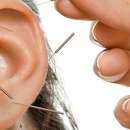 Michael L Miller L.ac Acupuncture - Acupuncture