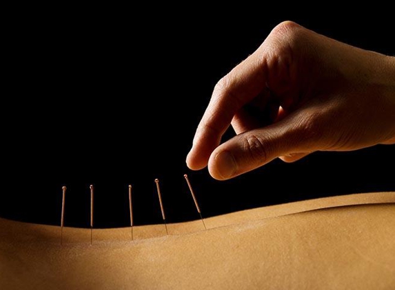 Acupuncture-Massage For Pain - New York, NY
