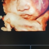 Love At First Sight 3D/4D Ultrasound Imaging Studio gallery