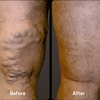 USA Vein Clinics gallery