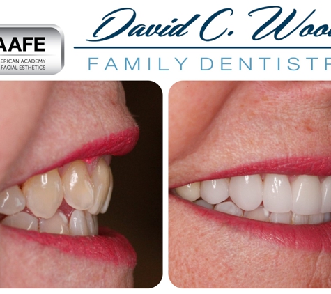 David Wood Family Dentistry - Carmel, IN