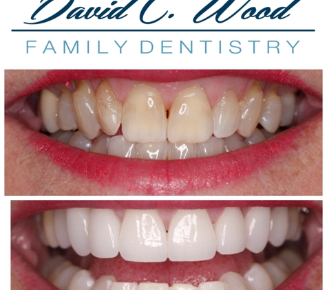 David Wood Family Dentistry - Carmel, IN