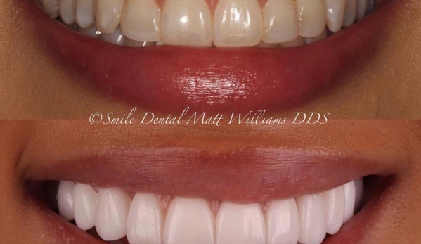 Smile Dental - Russellville, AR