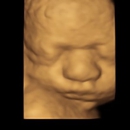 Precious Baby Peek Ultrasound - Medical Imaging Services