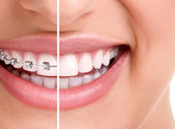 Southfield Orthodontist - Southfield, MI