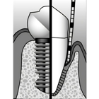 Advanced Periodontics