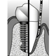 Advanced Periodontics