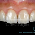 Ultimate Styles Dental Lab