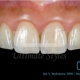 Ultimate Styles Dental Lab