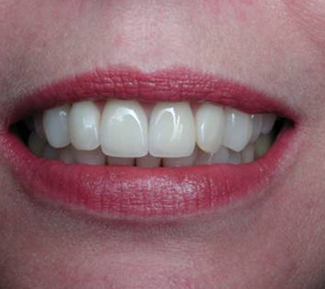 Esthetic Implant Gold Dental Center - North Hollywood, CA