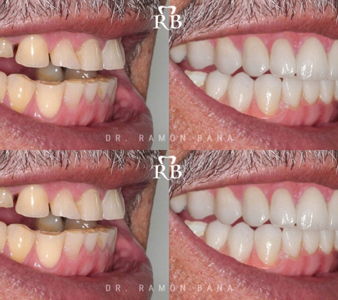 Ramon Bana DDS - Coral Gables, FL