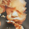 Love At First Sight 3D/4D Ultrasound Imaging Studio gallery