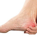 Manhattan Foot Specialists - Physicians & Surgeons, Podiatrists