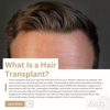 Arocha Hair Restoration gallery