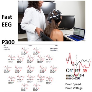 Midwest Brain Health Technology-WAVi - Mission, KS