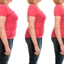 Medical Weight-Loss Solution - Weight Control Services