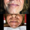 Electrolysis Center Laser Hair Removal gallery