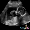 Mommy2Bee 4D Ultrasound gallery