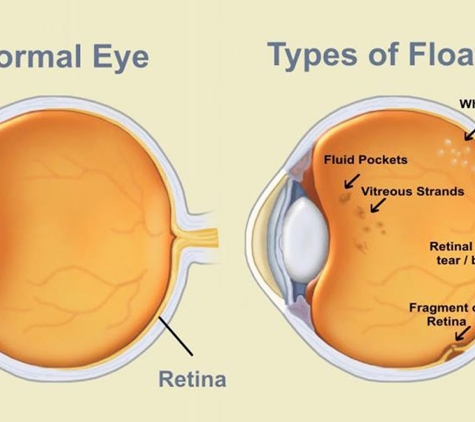 Eye Surgicentre The - Erina, NSW