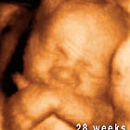 Fetal Fotos Utah County - Clinics