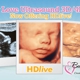 Baby Love Ultrasound