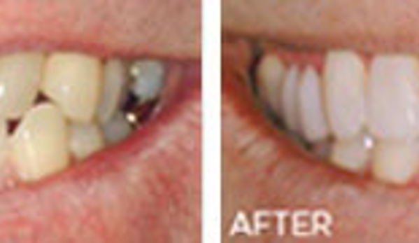 Gretchen Hoover DDS - Austin, TX