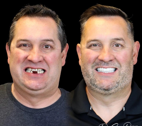 Smile Now Denver Dentures and Implants - Westminster, CO