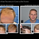 Chicago Hair Transplant Clinic