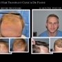 Chicago Hair Transplant Clinic