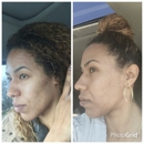 Cherrelle's Aesthetics - Skin Care