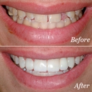 Smiles by Beck & Bailey - Implant Dentistry