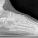 Comprehensive Foot & Ankle Center of South Jersey - Physicians & Surgeons, Podiatrists