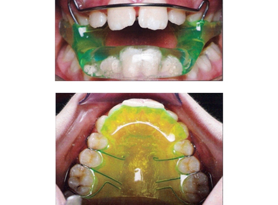 Orthoshop Orthodontic Laboratory - Perth, WA