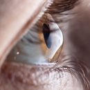 Cleveland Eye Clinic - Physicians & Surgeons, Ophthalmology